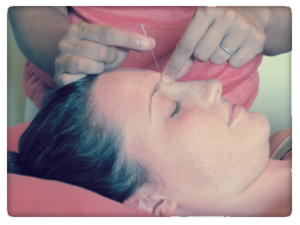 Acupuncture & Chinese Medicine by Dr. Martin, Vermont Natural Family Health